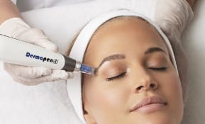 Dermapen Skin Needling