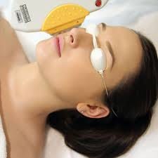 IPL skin rejuvenation